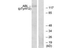 Western blot analysis of extracts from RAW264. (ABL1 anticorps  (pTyr393))