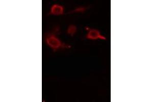 ABIN6275499 staining  RAW264. (ARHGEF5 anticorps  (Internal Region))