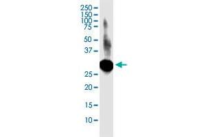 LACTB2 monoclonal antibody (M02), clone 1H3.