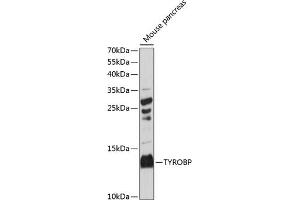Western blot analysis of extracts of mouse pancreas, using TYROBP antibody (ABIN7271115) at 1:3000 dilution. (TYROBP anticorps  (C-Term))