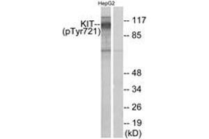 Western Blotting (WB) image for anti-Mast/stem Cell Growth Factor Receptor (KIT) (pTyr721) antibody (ABIN2888461) (KIT anticorps  (pTyr721))