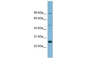 LRRC49 antibody used at 1 ug/ml to detect target protein. (LRRC49 anticorps  (N-Term))