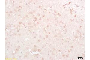 Formalin-fixed and paraffin embedded rat brain labeled with Rabbit Anti DRP1/DNM1L Polyclonal Antibody, Unconjugated  at 1:200 followed by conjugation to the secondary antibody and DAB staining (CSRP2 anticorps  (AA 101-200))
