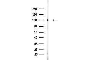 anti-STT3, Subunit of The Oligosaccharyltransferase Complex, Homolog A (STT3A) (Internal Region) antibody