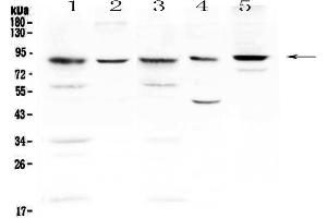 Western blot analysis of NADPH oxidase 4 using anti-NADPH oxidase 4 antibody . (NADPH Oxidase 4 anticorps)