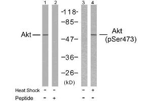 Western blot analysis of extract from HeLa cells untreated or treated with heat shock using Akt (Ab-473) antibody (E021054, Lane 1 and 2) and Akt (phospho-Ser473) antibody (E011054, Lane 3 and 4). (AKT1 anticorps  (pSer473))
