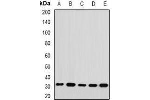 Western blot analysis of RPL14 expression in Jurkat (A), HepG2 (B), mouse spleen (C), mouse ovary (D), rat kidney (E) whole cell lysates. (RPL14 anticorps)