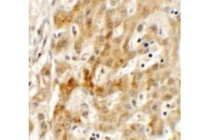 Immunohistochemistry of TMEM106B in human liver tissue with TMEM106B antibody at 2. (TMEM106B anticorps  (N-Term))