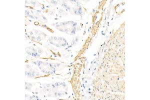 Immunohistochemistry of paraffin-embedded rat kidney using Caspase-7 Rabbit pAb (ABIN3022071, ABIN3022072, ABIN3022073 and ABIN6218596) at dilution of 1:150 (40x lens). (Caspase 7 anticorps  (AA 24-303))