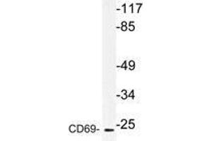Western blot (WB) analysis of CD69 antibody in extracts from HUVEC cells. (CD69 anticorps)