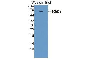 Figure. (TTBK2 anticorps  (AA 21-314))