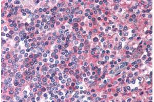 Anti-EMR2 antibody  ABIN1048546 IHC staining of human spleen. (EMR2 anticorps  (N-Term))