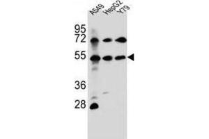 Western Blotting (WB) image for anti-Fibroblast Growth Factor Receptor-Like 1 (FGFRL1) antibody (ABIN2996911) (FGFRL1 anticorps)