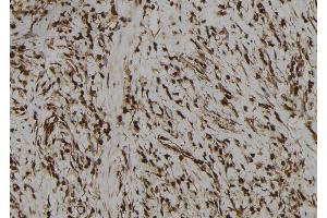 ABIN6272973 at 1/100 staining Human gastric tissue by IHC-P. (PBXIP1 anticorps  (C-Term))