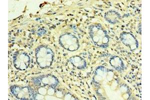 Immunohistochemistry of paraffin-embedded human small intestine tissue using ABIN7166178 at dilution of 1:100