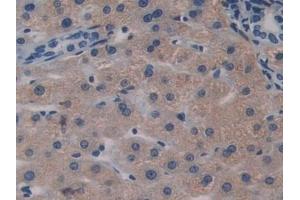 Detection of BGN in Human Liver Tissue using Polyclonal Antibody to Biglycan (BGN)