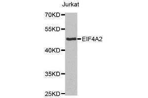 anti-Eukaryotic Translation Initiation Factor 4A2 (EIF4A2) (AA 1-270) antibody