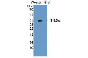 Western blot analysis of the recombinant protein. (ADAM12 anticorps  (AA 513-767))