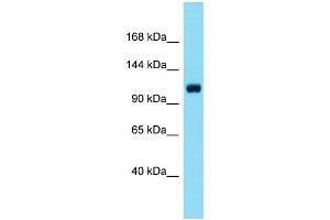Host: Rabbit  Target Name: Scube1  Sample Tissue: Mouse Liver lysates  Antibody Dilution: 1. (SCUBE1 anticorps  (C-Term))