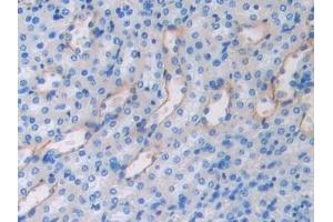 Detection of FBLN4 in Mouse Kidney Tissue using Polyclonal Antibody to Fibulin 4 (FBLN4)