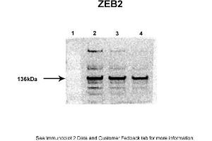 Sample Type: 1. (ZEB2 anticorps  (Middle Region))