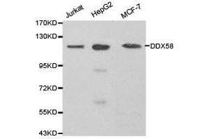 Western Blotting (WB) image for anti-DEAD (Asp-Glu-Ala-Asp) Box Polypeptide 58 (DDX58) antibody (ABIN1872240) (DDX58 anticorps)