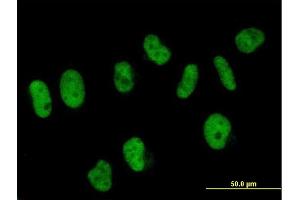 Immunofluorescence of purified MaxPab antibody to SART3 on HeLa cell. (SART3 anticorps)