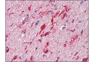 Immunohistochemistry (IHC) image for anti-Hepatocyte Growth Factor (Hepapoietin A, Scatter Factor) (HGF) antibody (ABIN492557) (HGF anticorps)