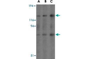 Western blot analysis of AGAP2 in mouse brain tissue lysates with AGAP2 polyclonal antibody  at (A) 0. (AGAP2 anticorps  (C-Term))