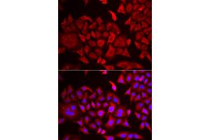 Immunofluorescence analysis of HeLa cells using TARS antibody (ABIN5974207). (TARS anticorps)
