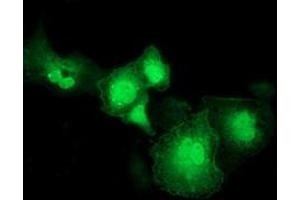 Anti-RASD2 mouse monoclonal antibody (ABIN2453962) immunofluorescent staining of COS7 cells transiently transfected by pCMV6-ENTRY RASD2 (RC201454). (RASD2 anticorps)