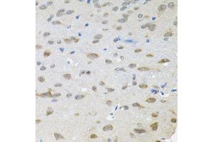 Immunohistochemistry of paraffin-embedded rat brain using TRPC1 antibody (ABIN6003660) (40x lens). (TRPC1 anticorps)