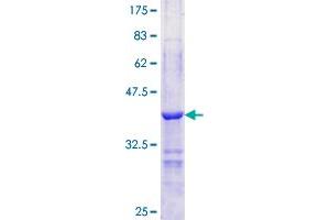 Image no. 1 for Perilipin 1 (PLIN1) (AA 101-208) protein (GST tag) (ABIN1315426)
