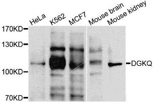 Western blot analysis of extracts of various cells, using DGKQ antibody. (DGKQ anticorps)