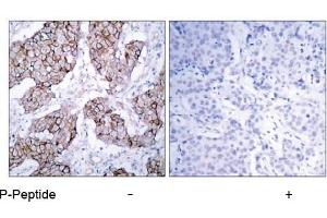 Image no. 2 for anti-Epidermal Growth Factor Receptor (EGFR) (pTyr1092) antibody (ABIN196760) (EGFR anticorps  (pTyr1092))