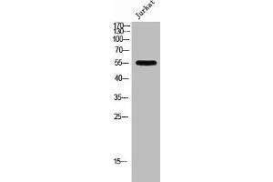 Western Blot analysis of Jurkat cells using PFK-2 liv Polyclonal Antibody