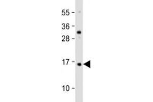 Western blot testing of human HaCaT cell lysate with TCTA antibody at 1:2000. (TCTA anticorps  (AA 23-55))