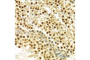Immunohistochemistry of paraffin-embedded Rat testis using MYSM1 antibody at dilution of 1:100 (x400 lens). (MYSM1 anticorps  (C-Term))