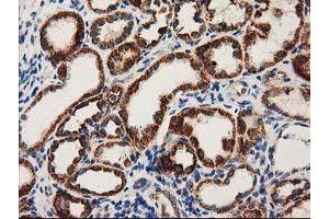 Immunohistochemical staining of paraffin-embedded Human Kidney tissue using anti-MMAB mouse monoclonal antibody. (MMAB anticorps)