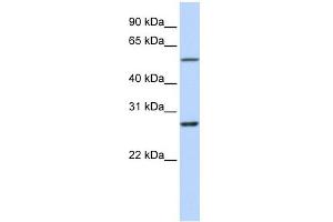 RNF217 antibody used at 1 ug/ml to detect target protein. (RNF217 anticorps  (Middle Region))