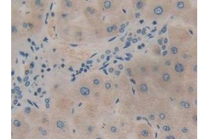 Detection of PIK3C3 in Human Liver Tissue using Polyclonal Antibody to Phosphoinositide-3-Kinase Class 3 (PIK3C3)