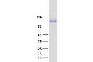 Validation with Western Blot