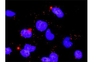 Proximity Ligation Analysis of protein-protein interactions between ARRB2 and PPM1B.