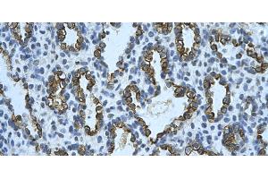 Rabbit Anti-KRT8 Antibody       Paraffin Embedded Tissue:  Human alveolar cell   Cellular Data:  Epithelial cells of renal tubule  Antibody Concentration:   4. (KRT8 anticorps  (N-Term))