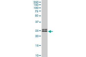 IGLL1 MaxPab rabbit polyclonal antibody. (IGLL1 anticorps  (AA 1-213))