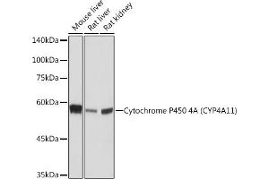 Western blot analysis of extracts of various cell lines, using Cytochrome P450 4A (CYP4) (CYP4) Rabbit mAb (ABIN7266658) at 1:1000 dilution.