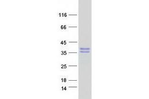 Validation with Western Blot