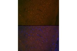 Immunofluorescence analysis of mouse brain using 5HT7 Receptor Rabbit mAb (ABIN7265341) at dilution of 1:100 (40x lens). (HTR7 anticorps)