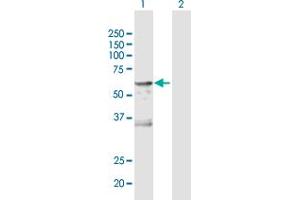 Western Blot analysis of CA9 expression in transfected 293T cell line by CA9 MaxPab polyclonal antibody. (CA9 anticorps  (AA 1-459))
