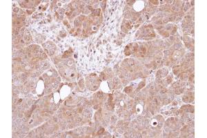 IHC-P Image Immunohistochemical analysis of paraffin-embedded SW480 xenograft, using AHA-1 , antibody at 1:100 dilution. (AHSA1 anticorps  (Center))